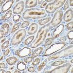 Caspase 8 Antibody in Immunohistochemistry (Paraffin) (IHC (P))