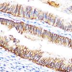 c-Raf Antibody in Immunohistochemistry (Paraffin) (IHC (P))