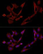 DOK4 Antibody in Immunocytochemistry (ICC/IF)