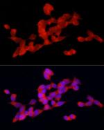 DOK4 Antibody in Immunocytochemistry (ICC/IF)