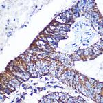 DOK4 Antibody in Immunohistochemistry (Paraffin) (IHC (P))