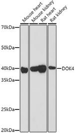 DOK4 Antibody in Western Blot (WB)