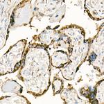 CD178 Antibody in Immunohistochemistry (Paraffin) (IHC (P))