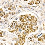 CD178 Antibody in Immunohistochemistry (Paraffin) (IHC (P))