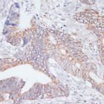 IKK epsilon Antibody in Immunohistochemistry (Paraffin) (IHC (P))