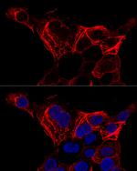 Cytokeratin 20 Antibody in Immunocytochemistry (ICC/IF)