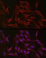 PIK3CA Antibody in Immunocytochemistry (ICC/IF)