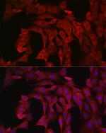 PIK3CA Antibody in Immunocytochemistry (ICC/IF)