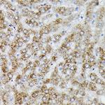 PIK3CA Antibody in Immunohistochemistry (Paraffin) (IHC (P))