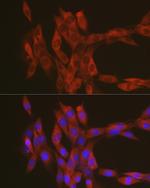 RhoA Antibody in Immunocytochemistry (ICC/IF)