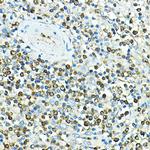 CD79a Antibody in Immunohistochemistry (Paraffin) (IHC (P))