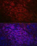 CD79a Antibody in Immunohistochemistry (Paraffin) (IHC (P))