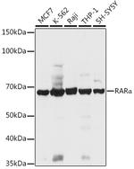 RARA Antibody in Western Blot (WB)
