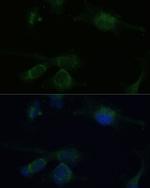 VHL Antibody in Immunocytochemistry (ICC/IF)