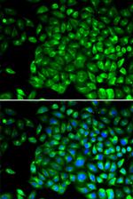 TNFR2 Antibody in Immunocytochemistry (ICC/IF)