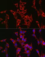 FGFR3 Antibody in Immunocytochemistry (ICC/IF)