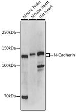 N-cadherin Antibody in Western Blot (WB)