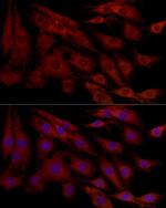 MCL-1 Antibody in Immunocytochemistry (ICC/IF)