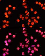 XRCC1 Antibody in Immunocytochemistry (ICC/IF)