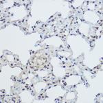 XRCC1 Antibody in Immunohistochemistry (Paraffin) (IHC (P))