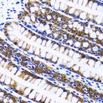 FASN Antibody in Immunohistochemistry (Paraffin) (IHC (P))