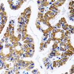 FASN Antibody in Immunohistochemistry (Paraffin) (IHC (P))