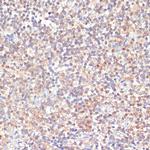 PKC delta Antibody in Immunohistochemistry (Paraffin) (IHC (P))