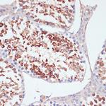 PKC delta Antibody in Immunohistochemistry (Paraffin) (IHC (P))