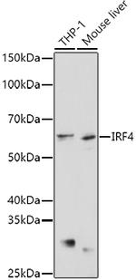 IRF4 Antibody in Western Blot (WB)