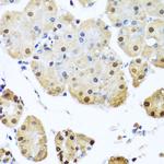 NuMA Antibody in Immunohistochemistry (Paraffin) (IHC (P))