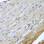 NuMA Antibody in Immunohistochemistry (Paraffin) (IHC (P))