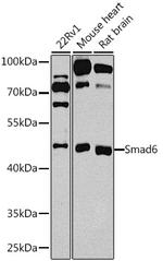 SMAD6 Antibody in Western Blot (WB)