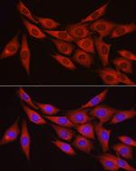 MYPT1 Antibody in Immunocytochemistry (ICC/IF)