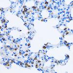 EEA1 Antibody in Immunohistochemistry (Paraffin) (IHC (P))