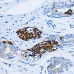 EEA1 Antibody in Immunohistochemistry (Paraffin) (IHC (P))