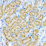 EEA1 Antibody in Immunohistochemistry (Paraffin) (IHC (P))