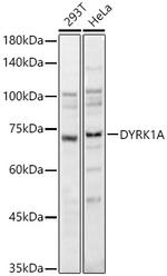 DYRK1A Antibody in Western Blot (WB)