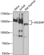 INCENP Antibody in Western Blot (WB)