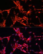 GSK3 alpha Antibody in Immunocytochemistry (ICC/IF)