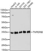 DcR3 Antibody in Western Blot (WB)