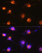 S100B Antibody in Immunocytochemistry (ICC/IF)