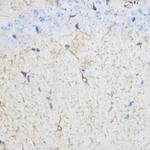 S100B Antibody in Immunohistochemistry (Paraffin) (IHC (P))