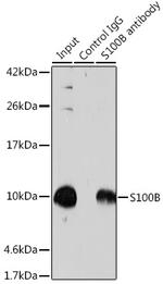 S100B Antibody in Immunoprecipitation (IP)