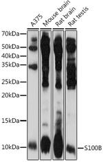 S100B Antibody in Western Blot (WB)