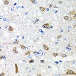 ACVR1C Antibody in Immunohistochemistry (Paraffin) (IHC (P))