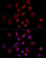 MMP7 Antibody in Immunocytochemistry (ICC/IF)