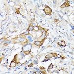 MMP7 Antibody in Immunohistochemistry (Paraffin) (IHC (P))