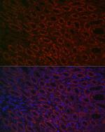 BMP-7 Antibody in Immunocytochemistry (ICC/IF)