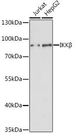 IKK beta Antibody in Western Blot (WB)