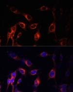 TSC1 Antibody in Immunocytochemistry (ICC/IF)